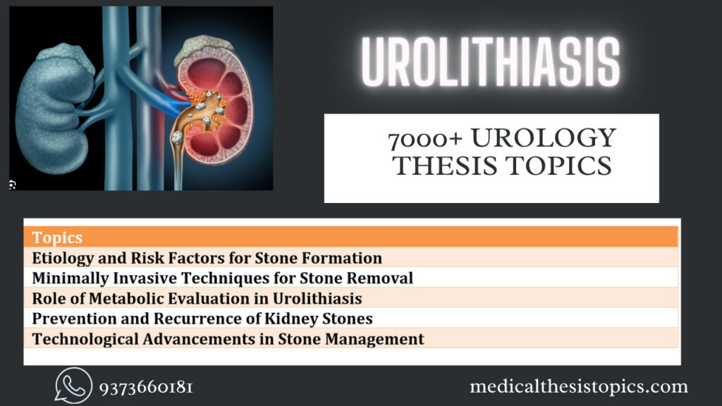 Urolithiasis Thesis Topics