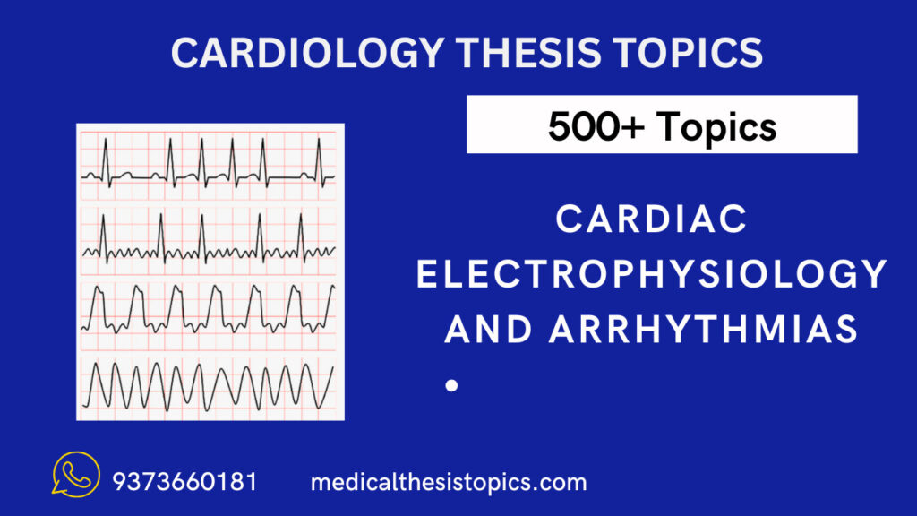 cardiology thesis topics on Arrhythmia