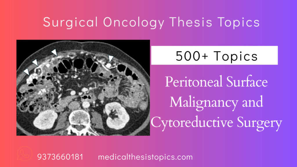 surgical oncology thesis topics