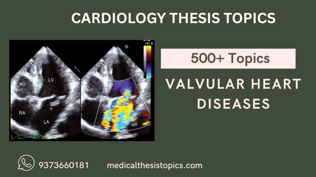 Cardiology thesis topics on valvular heart diseases​